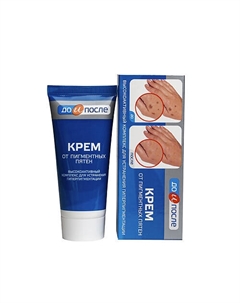 Крем от пигментных пятен 50 До и после