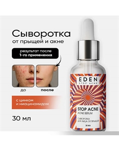 Сыворотка для лица от прыщей Stop Acne 30 Eden